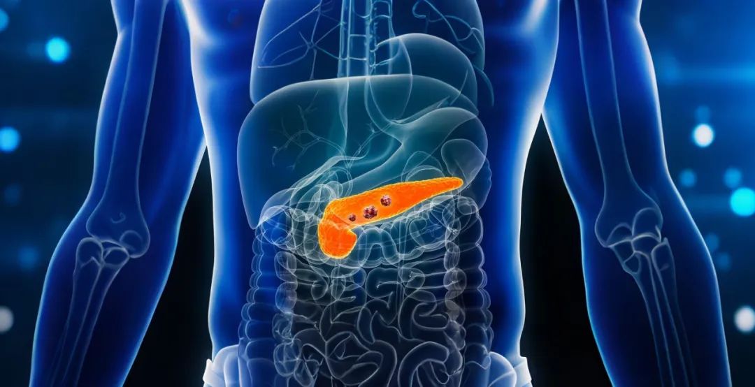 破局：无痛生存大幅提升6个月！这种可穿戴的治疗给癌症“王中王”治疗带来曙光